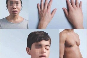 罕见病人跨越300公里求医 医院14分钟成功救命