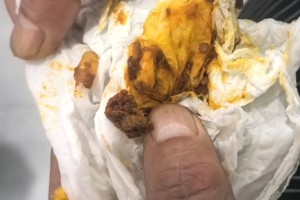 陕西神木市一学校餐厅吃出异物？校方辟谣